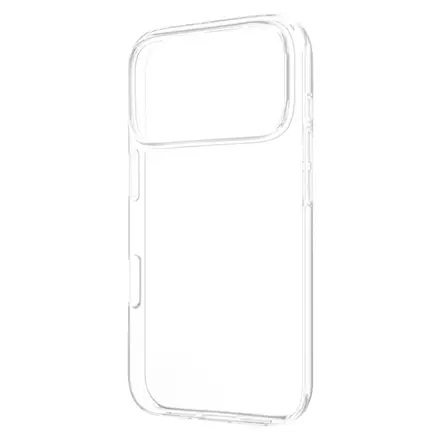 Fixed Story Back cover Xiaomi
